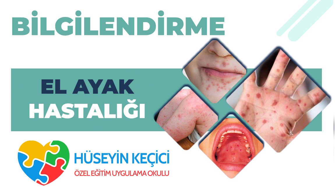 EL AYAK HASTALIĞI BİLGİLENDİRME